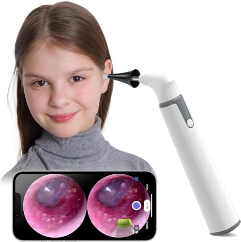 ScopeAround Otoscope, Camera Oreille avec 6 Lumières LED, Camera Oreille Nettoyage de 3,9 mm pour Enfants, Adultes et Animaux de Compagnie, Video Otoscope Compatible avec Android/iPhone/iPad (Blanc)